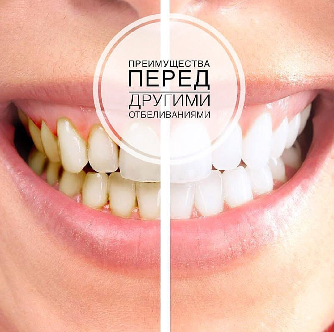 VIAILA Advanced Teeth Whitening Device