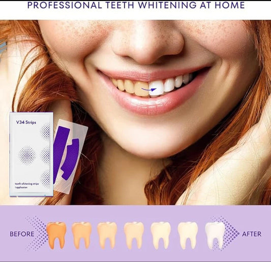 SMILE V34 Teeth Whitening Strips